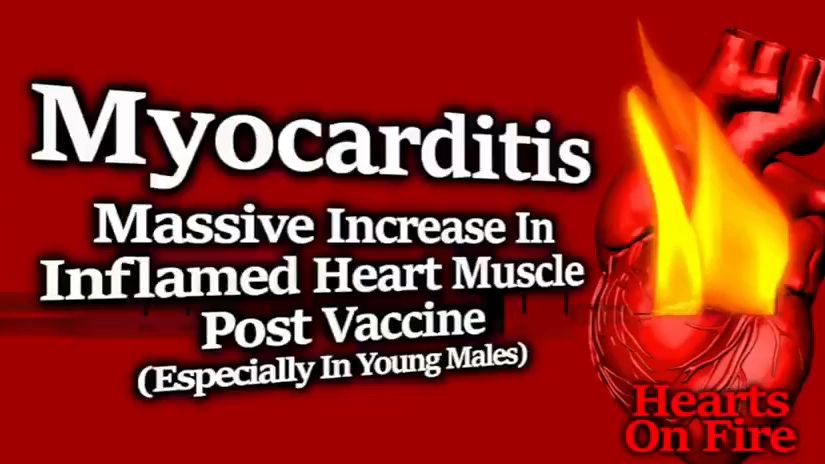Nature Communications, Le Vue et al: Myocarditis risk increased ten times after “vaccination” for COVID-19